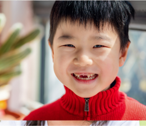Sonrisa de un niño de 5 años al que le faltan dientes