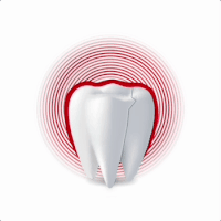 diente problemas dentales